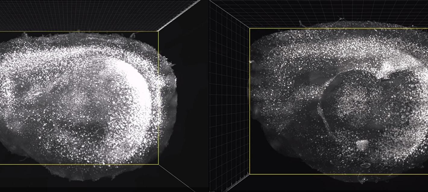 Two mouse brains are shown side by side with white dots marking amyloid protein
