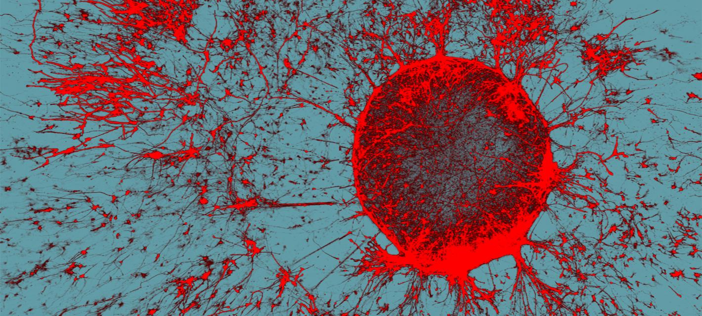 On a gray-blue background there is a circle made of bright-red stained neurons. The neurons radiate out from the circle edge, like solar flares, reaching across the image.