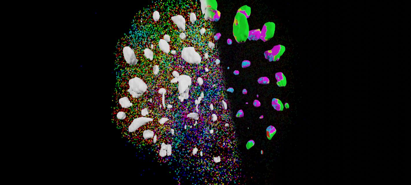 A color-coded image of an organoid highlights ventricles and the locations of different cell types