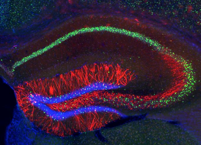 Neurons in a mouse hippocampus are labeled in blue, red and other colors
