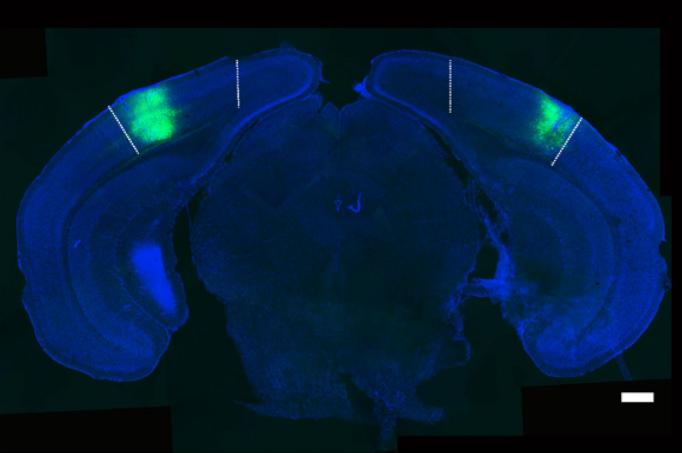A cross section of a mouse brain is stained blue but light green highlights areas near the top, symmetrically on both sides