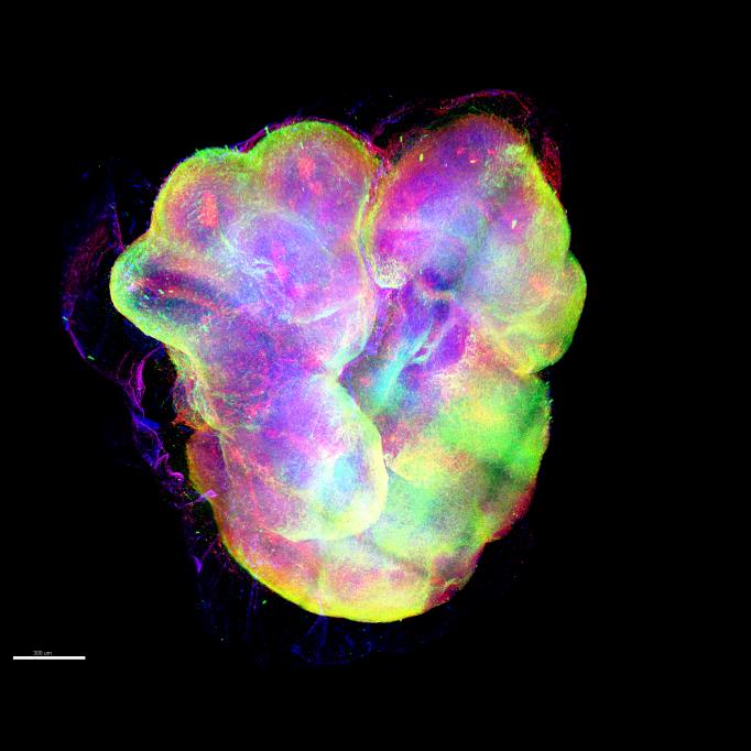 An organoid is colorfully stained to indicate neurons and glial cells