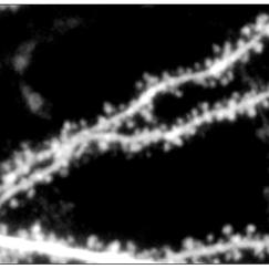 A black and white image shows sections of neural dendrites which appear as long thin lines with many small bumps along them.