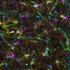 A beautiful view of hundreds of different brain cells stained in bright colors