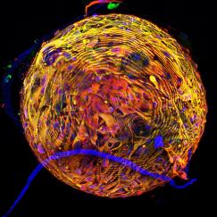 A graphic including the logos of the Alana Down Syndrome Center, the Massachusetts Down Syndrome Congress and a yellow ball of cultured cells.