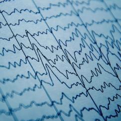 A closeup of a piece of paper displaying many squiggly lines of brainwaves