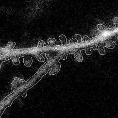 On a black background a spiny section of a neural dendrite is outlined in white. Within the outline numerous little white dots indicate the actual dendrite within the outline.