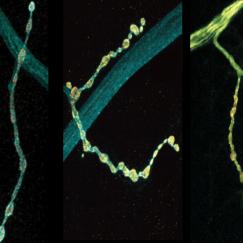 On a black background three panels show a branch of a neuron where there is a thick main part and a thinner protrusion lined with little bulbs. The leftmost panel shows a gray main part with a somewhat yellow protrusion. The middle shows a grey thin part with a very yellow protrusion. In the right panel everything is very yellow.