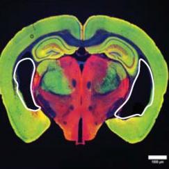 Alzheimer's mouse model brain showing enlarged ventricles