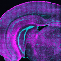 A cross section of a mouse brain glows with a magenta hue. Many individual speckles across the whole brain are lit up brighter.
