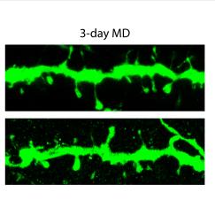 An array of six panels shows different views of a long, thin, spiny structure that closely resembles a bumpy twig. Each is stained bright green and the degree of bumpiness varies along each one.