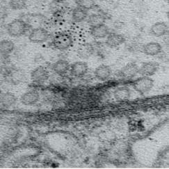 Two stacked electron microscope images show a synapse. Above a small, river-like gap is a dark T shape among many tiny bubble-like circles. In the bottom image the T shape is much bigger than in the upper image.