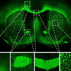 Two green-stained cross sections of a mouse brain, one labeled Cuprizone Control and one labeled Cuprizone 40Hz,, are accompanied by insets showing magnifications of parts specific brain regions. The green staining in each inset is greater and brighter in the 40Hz insets vs. the control insets.