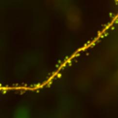 A dendrite lit up yellow-green snakes from the lower left to the upper right