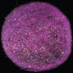 Two panels show round cerebral organoids, which appear as a dense tangle of magenta and cyan strands speckled with bright yellow dots. The one on the right, labeled "+Gsk3b inhibition" has much more of the pink strands than the one on the left, labeled "APOE4 myelinoid"