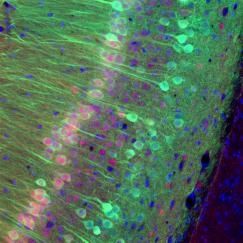An image of neurons in the hippocampus