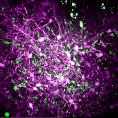 Three views of an organoid cell culture show the constiuent cells of the vaguely round, tangled mass of cells.  In the different views the cells are highlighted in different colors such as magenta and green.