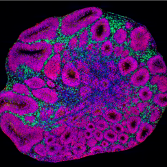 A nearly circular shape has many smaller magenta circles within that have black centers. In the middle there are blue patches and along top and left edges there are yellow-green speckles.