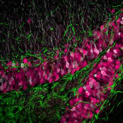 Neural tissue processed using MAP technology