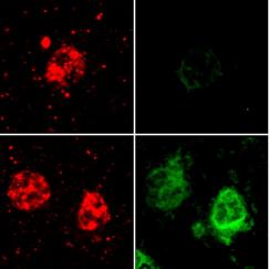 An array of six images shows that oligodendrocytes high in amyloid also express more of two proteins