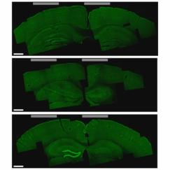 A brain slice that shows the hippocampus cells that were activated by the new stimulation technique (bottom image, lighter green areas on the left)