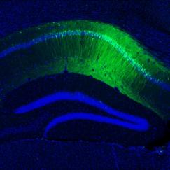 A hippocampal slice with green neurons representing a memory engram
