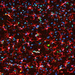 Hundreds of crab-shaped, red-stained microglia, accompanied by the blue-stained nuclei of neurons, cover the field of view against a black background.