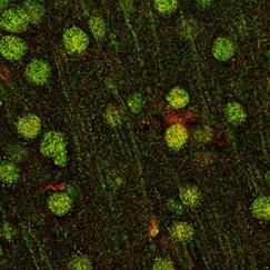 green staining shows MVP protein in neurons