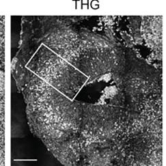 A horizontal strip of five panels shows successive zooming in on a section of an organoid. In each level of zoom traditional staining is compared with THG imaging.