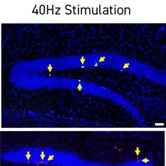 A 2 by 2 array of panels that each show a hairpin-like shape of blue stained cells. The left column is laberled "Ambient light/sound." The right column is labeled "40Hz Stimulation." The panels in the 40Hz column show more yellow arrows pointing white blotches than the panels in the ambient column.