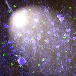 A rendering of a  fiber optic cable shining light on neurons