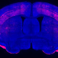A cross-section of a mouse's brain is stained royal blue. Around the outer edge along the top there are many bright pink spots.