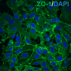 Two panels show blue cells surrounded by thin green outlines. The outlines are much more consistent and prevalent in the image on the left, which is labeled as the wild type, than on the right which is labeled Rett syndrome.