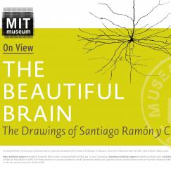 Graphic of some of cajal's drawings.