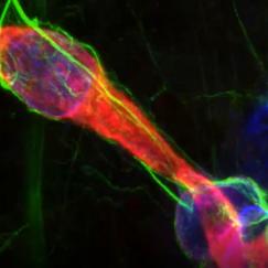 An image derived from MAP technology shows interaction between an astrocyte and endothelial tissue