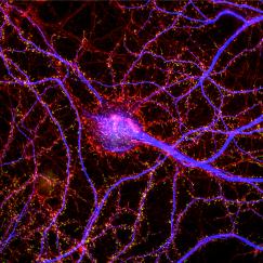 A red and purple stained neuron hiighlights its many branched and spiny dendrites