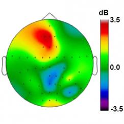 An outline of the top view of a head shows the brain filled in with colors corresponding to theta rhythm strength