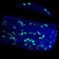 A horizontal arrangement of three circles on a black background and framed with pale yellow stripes show colorfully stained cells in tissues.