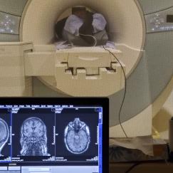 In the foreground there is a monitor showing brain anatomy scans. Behind that is a window looking upon an MRI scanner. We see a person's feet in the scanner's tube.
