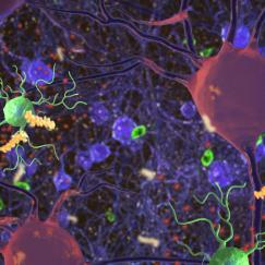 A cartoon shows light green branchy microglia cells, floating around among red neurons and smaller yellow blobs of amyloid protein