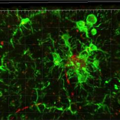 Green microglia cluster around a clump of amyloid beta protein