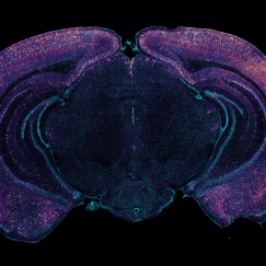 A coronal cross-section of a mouse brain is stained blue. The entire outer edge and occasional points further inside are speckled with yellow-green dots. The background behind the brain is black.