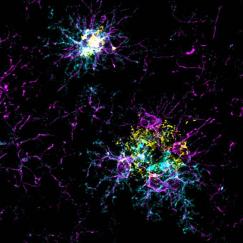 Spidery magenta stained cells, some of which have white areas, cluster around green clumps. The background is black.