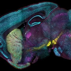 A saggital cross section of a mouse brain is richly stained in three distinct colors in three distinct areas: yellow in the very front and about halfway toward the back; green in a large area toward the front and cyan across wide areas, especially the cerebellum in the back