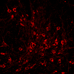 Reddish stained cells appear sprinkled over a black background
