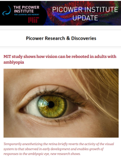 E-news screenshot features a closeup of a woman's eye and the headline "MIT study shows how vision can be rebooted in adults with amblyopia"