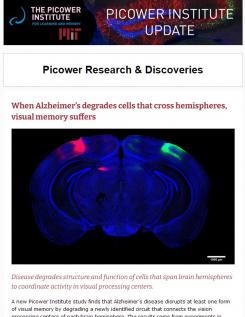 Newsletter screenshot features a blue cross section of a mouse brain under the headline "When Alzheimer's derades cells that cross hemispheres, visual memory suffers"