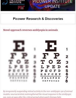 A screenshot shows the "Picower Institute Update" banner, the top headline "Novel approach reverses amblyopia in animals" and an eye chart where the left side is blurry