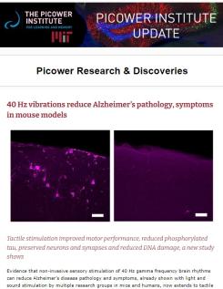 E-news screenshot features a magenta-hued image showing Alzheimer's afflicted neurons lit up because of an excess of tau protein