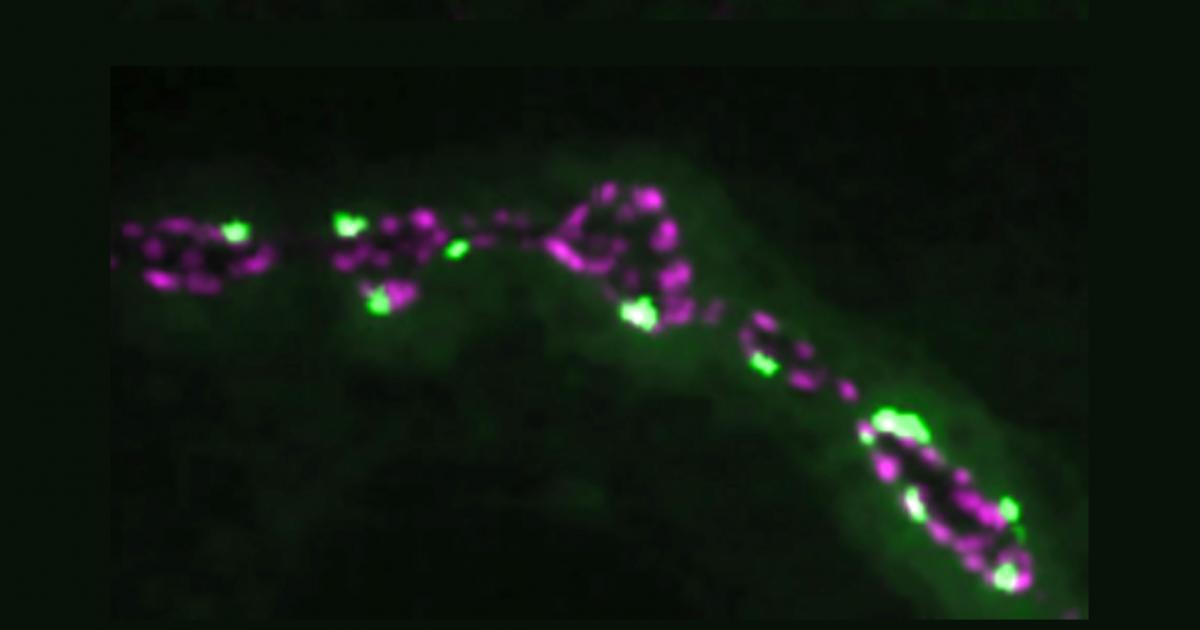 Individual neurons mix multiple RNA edits of key synapse protein, study  finds, MIT News